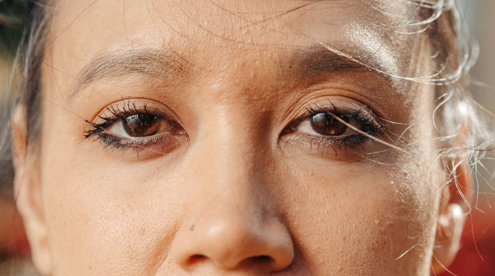 Close-up of a woman's eyes showing sensitivity and redness around the eyelids — eyelid eczema symptoms and treatment
