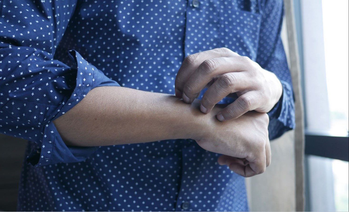 close-up of a person scratching irritated skin on their arm — eczema and hives can look similar but have different causes and timelines